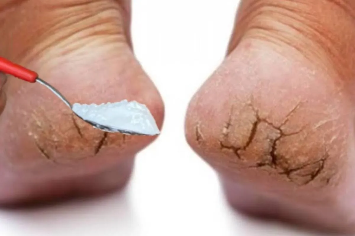 Como alisar pés rachados: não precisa gastar dinheiro com pr