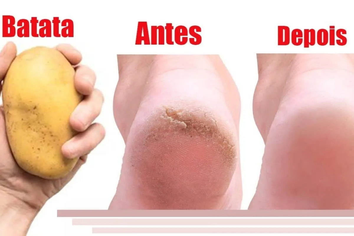 Como deixar os pés lisos e hidratados: técnica infalível que