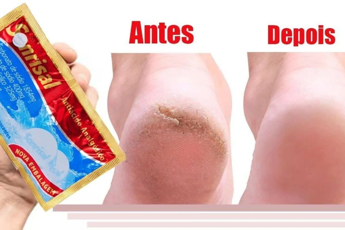 Como hidratar pés rachados e ressecados sem precisar ir na p