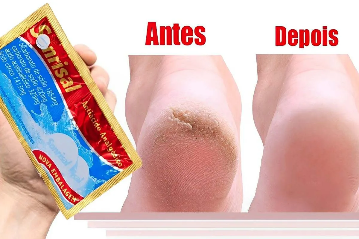Como hidratar pés rachados usando 3 ingredientes que você te