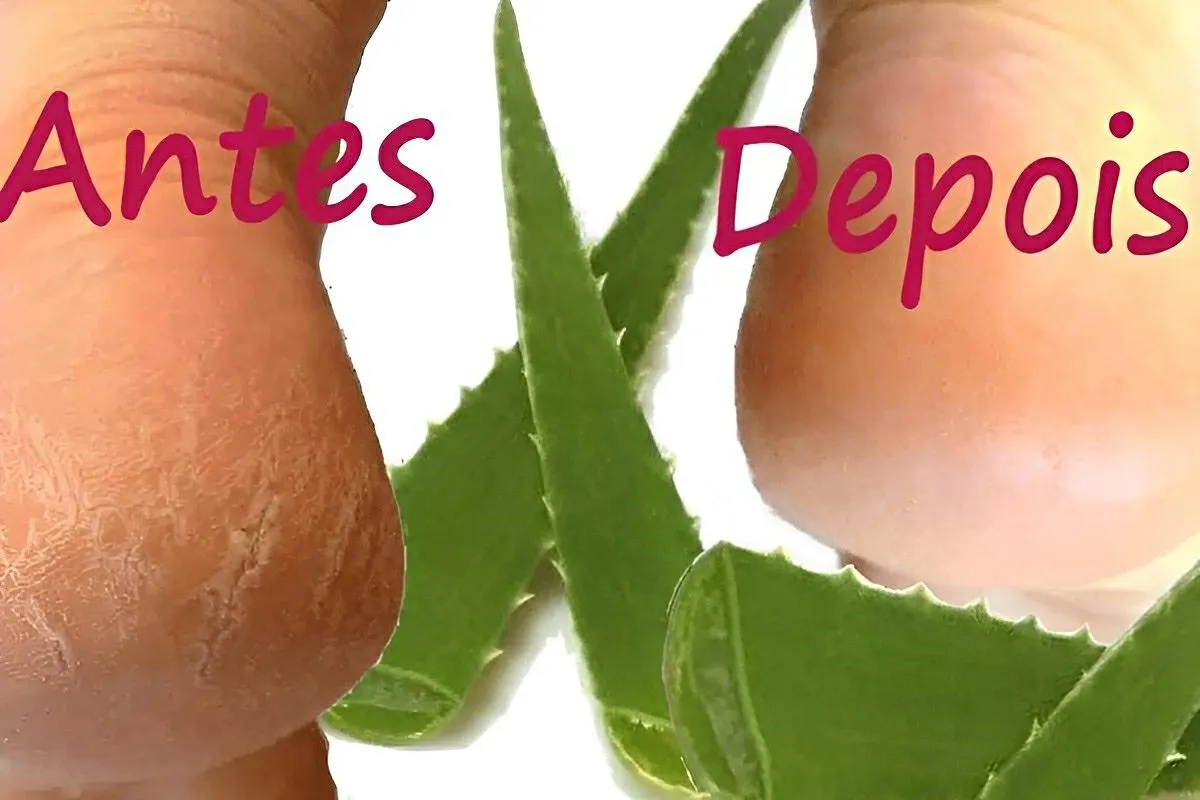 Como tirar rachaduras dos pés sem gastar muito usando apenas