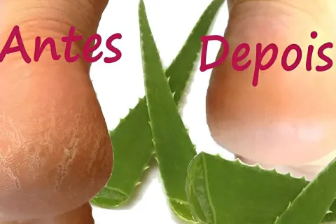 Como tirar rachaduras dos pés sem gastar muito usando apenas