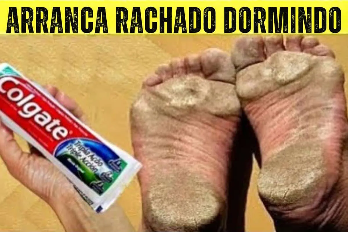 Dica para pés rachados e com calos: seus pês vão ficar lisin