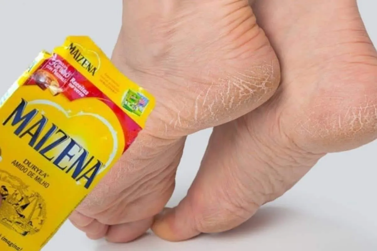 Dica para pés rachados e ressecados: acaba com as rachaduras