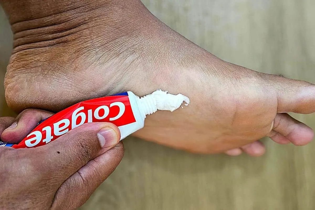 Dica para pés ressecados ficarem lisinhos e sem rachaduras s