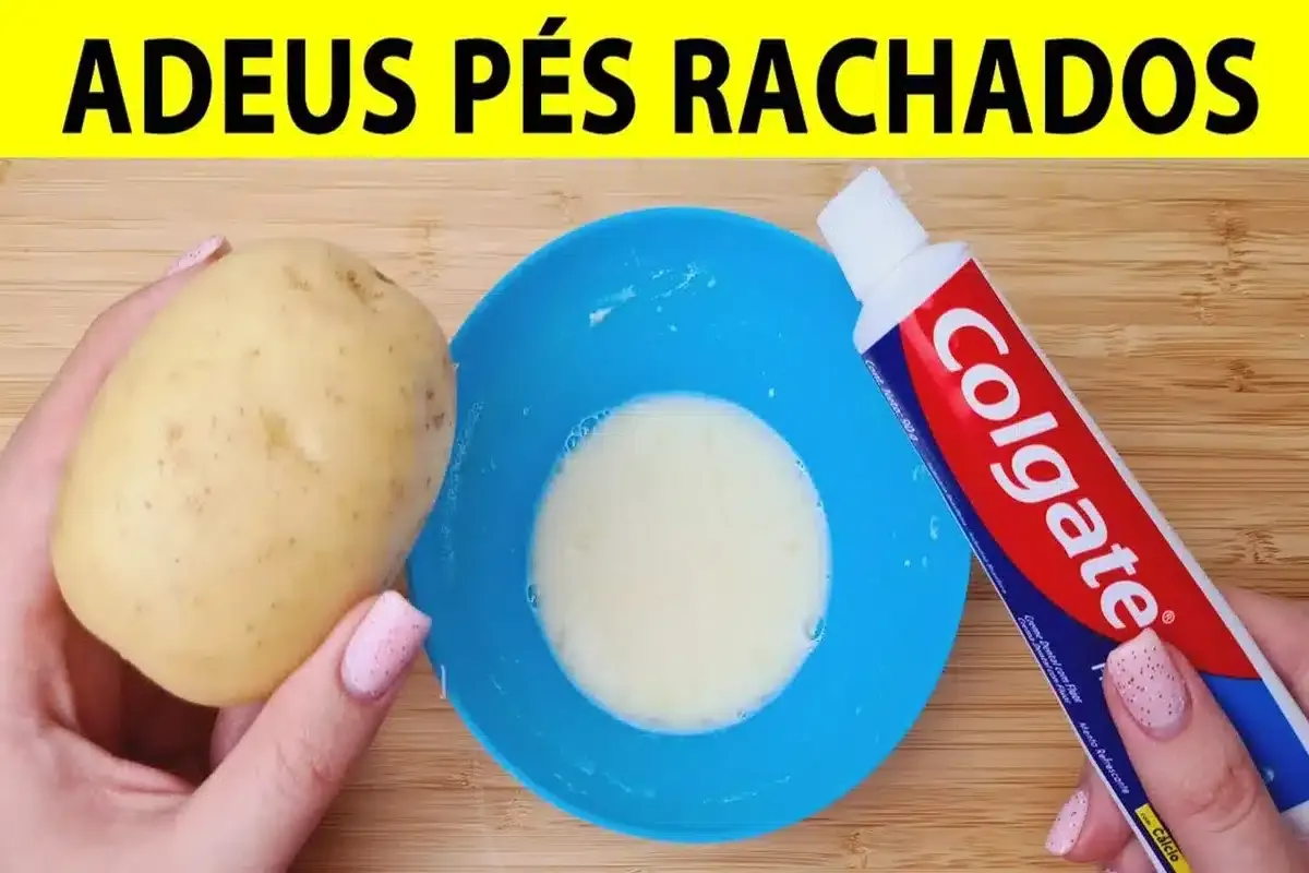 Essa é a melhor dica para pés rachados que você vai encontra