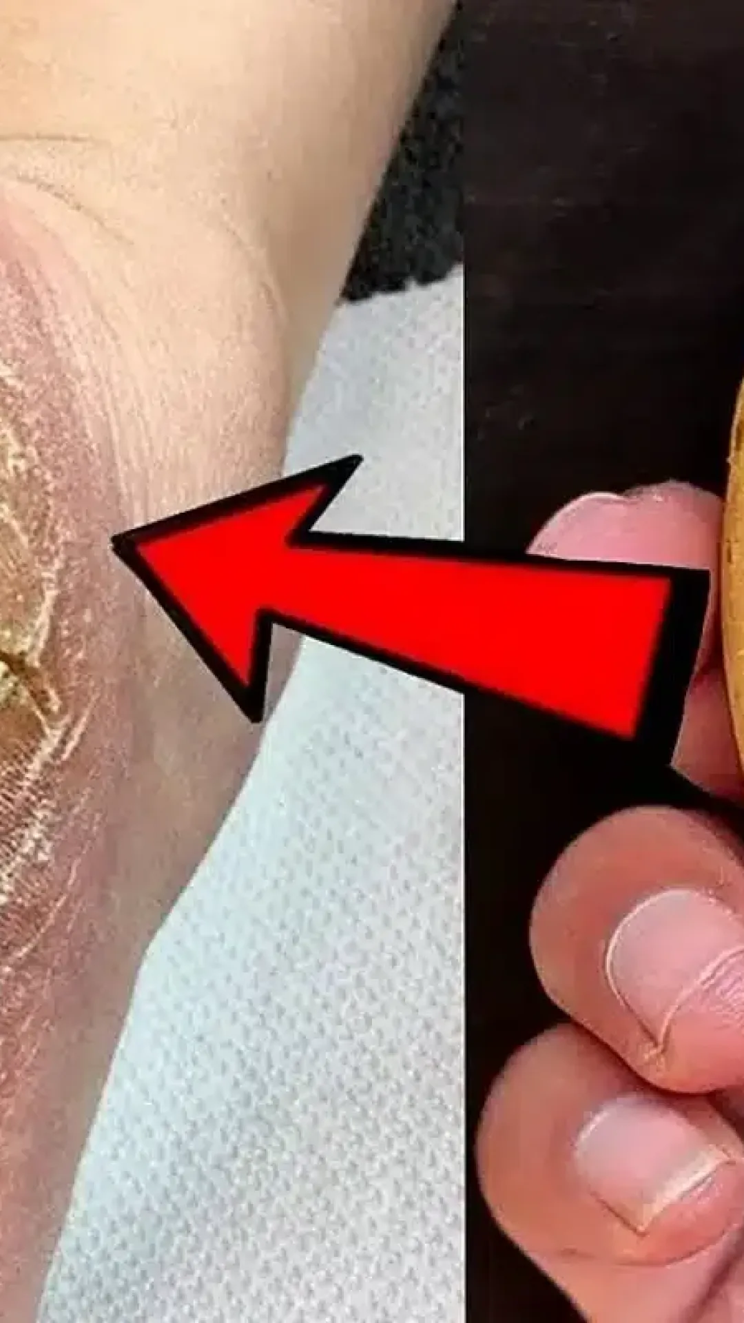 Como acabar com rachaduras dos pés: dica muito prática que aprendi com uma podóloga
