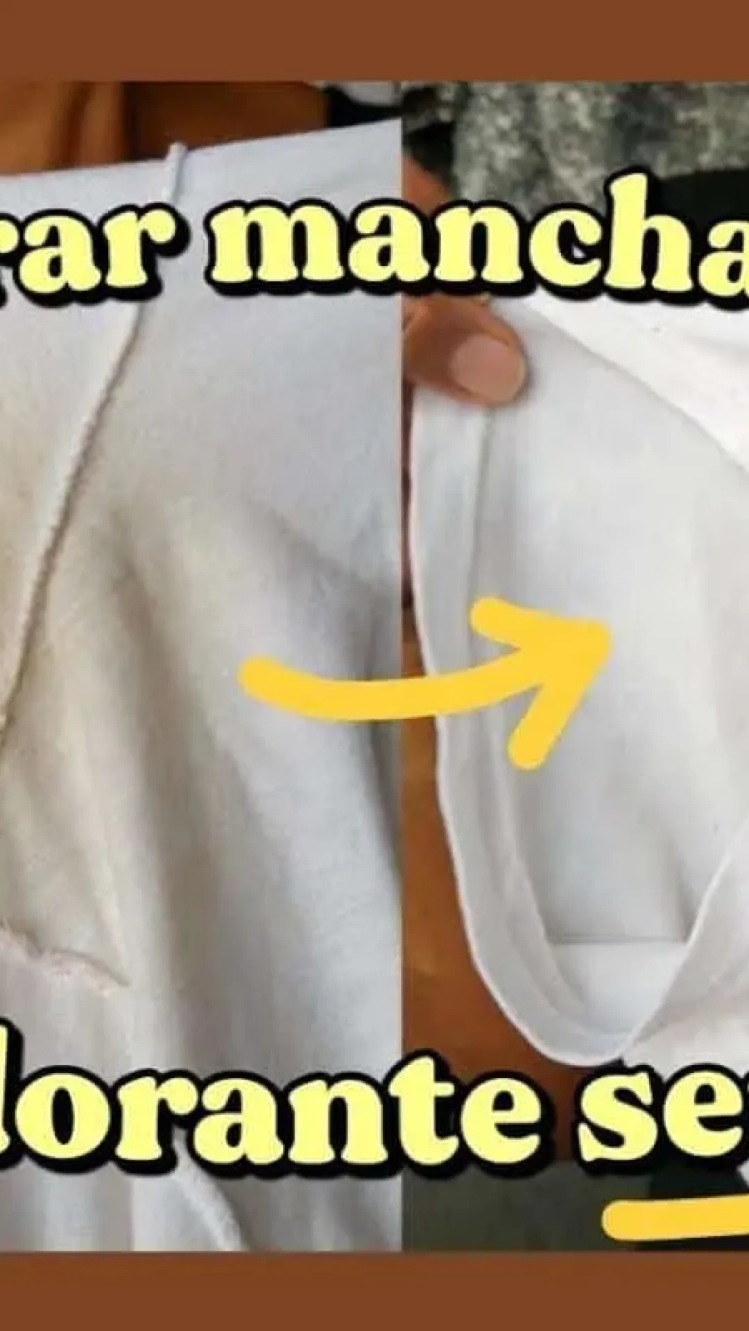 Como tirar mancha de roupa branca: agora não vai ter mais roupa encardida em casa