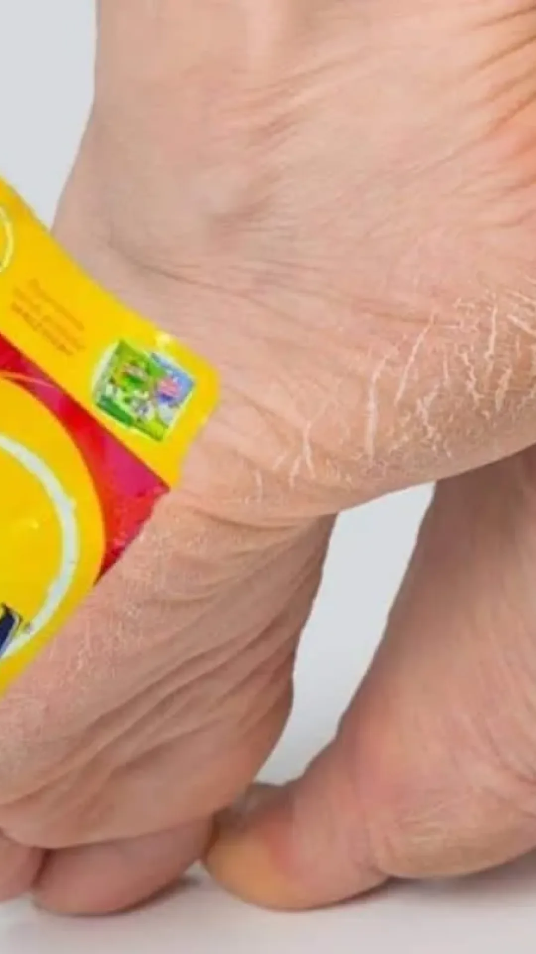 Como tirar rachaduras dos pés usando produtos que você já tem no armário