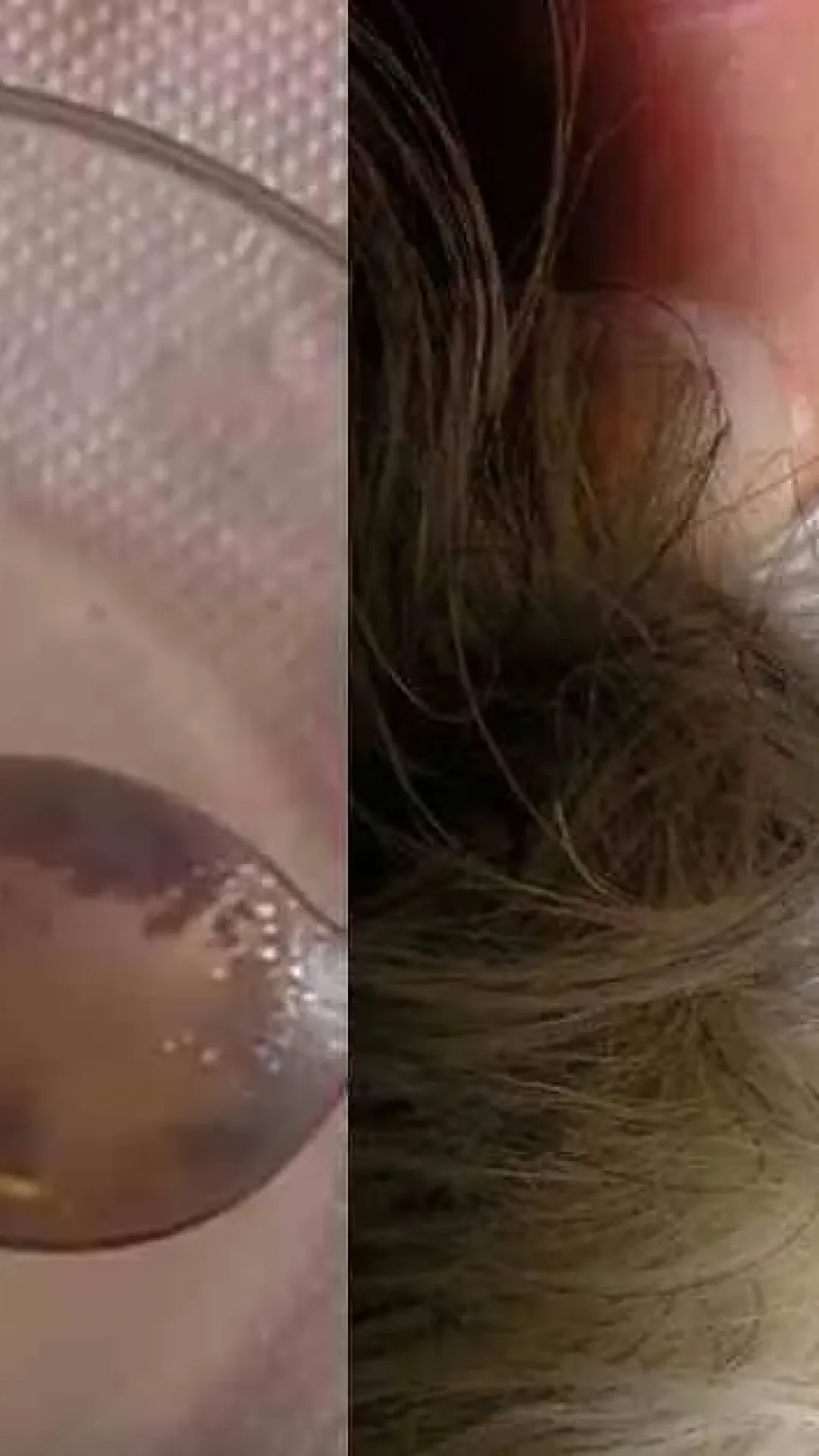 Receita Caseira para ELIMINAR PULGAS e CARRAPATOS do seu ANIMAL de ESTIMAÇÃO com BICARBONATO de SÓDIO